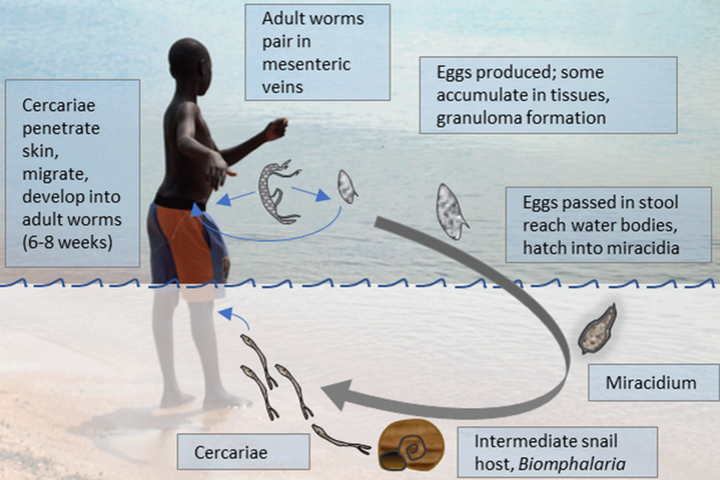 Schistosomiasis